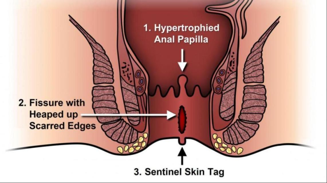 Nasty sex stuff